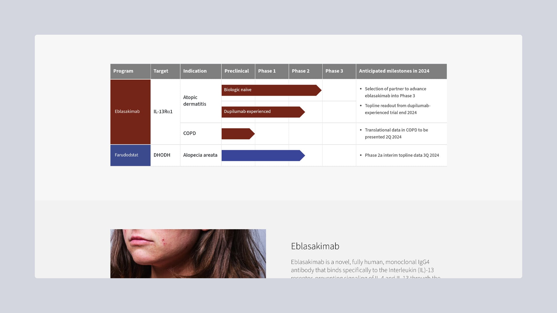 Clinical drug development chart and woman showing acne